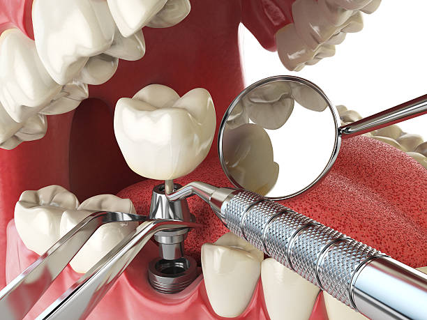 Best Emergency Gum Treatment in Water Valley, MS